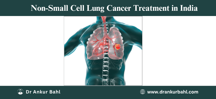 Non-Small Cell Lung Cancer (NSCLC) Treatment Cost in India