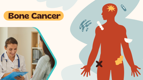 Bone Cancer Treatment Cost in India